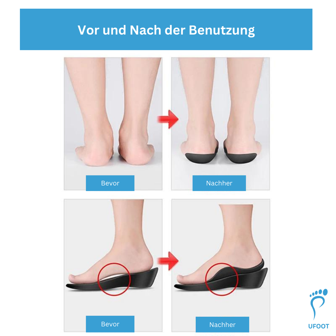 Orthopädische Schuheinlagen | Einlegesohlen  ufoot   